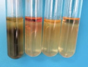 Biochemical Tests: Gram Positive and gram Negative Bacteria Assignment ...